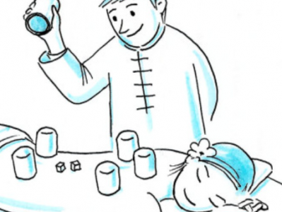 海口spa拔火罐疗法